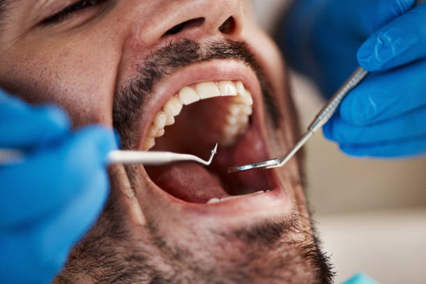 Best Broken or Cracked Tooth Emergency Dentist in Summit Park, UT